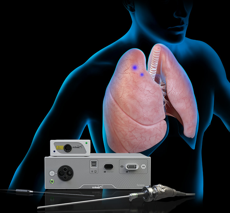 Arthrex - Cardiothoracic Surgery